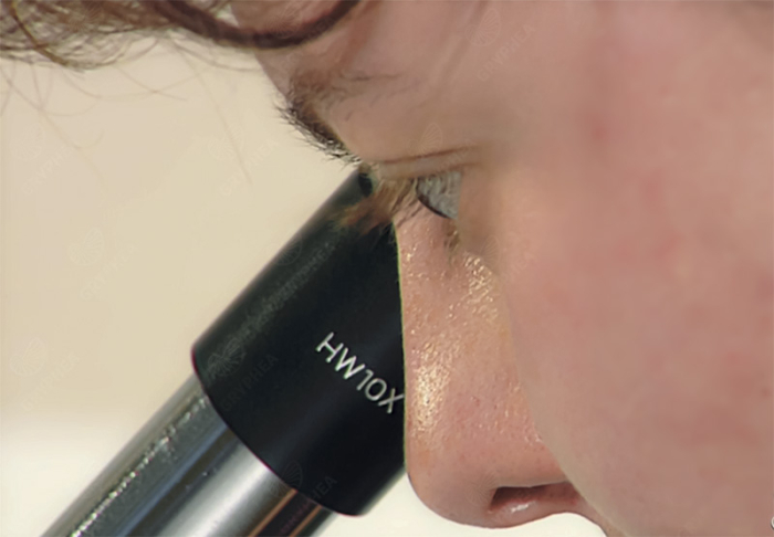 L'observation des préparations microscopiques - bases - gryphea.com